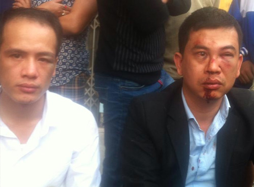 Luật sư Trần Thu Nam (bên phải) và luật sư Lê Văn Luân sau khi bị hành hung tại xã Đông Phương Yên (huyện Chương Mỹ, Hà Nội) vào chiều 3/11. Ảnh: Facebook luật sư Trần Thu Nam