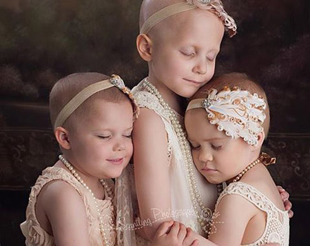 Rung động trái tim với bộ ảnh ba bé gái ung thư