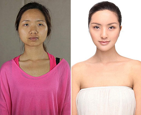 Xu hướng phẫu thuật thẩm mỹ làm đẹp của phụ nữ Trung Quốc